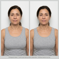 Lymphatic Wellness Drops 8